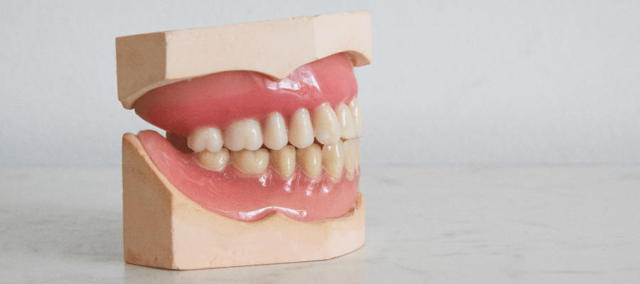 Bonding zębów, na czym polega